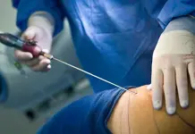 Alerta Coepris por m&eacute;dico sin certificaci&oacute;n para cirug&iacute;as est&eacute;ticas