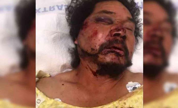 Recaudan fondos para mexicano golpeado por afroamericanos en Los Ángeles
