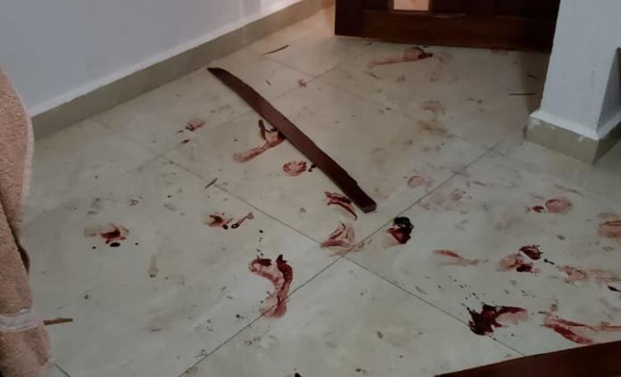Maleantes allanan domicilio de candidata priista en Axtla y balean a cuñado
