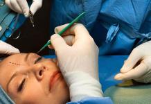 Alertan médicos que reforma en Ley General de Salud beneficia monopolización de la cirugía plástica