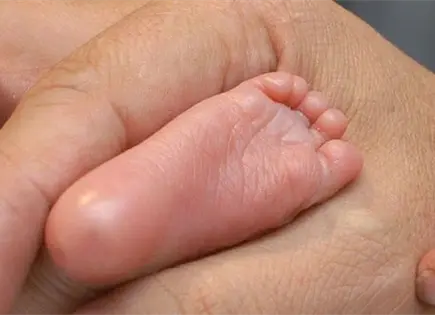 Nacen trillizos en hospital de San Luis de la Paz