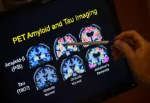 Pocos m&eacute;dicos realizan evaluaciones cognitivas a ancianos