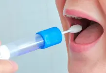 Prueba de saliva puede predecir riesgo de infarto