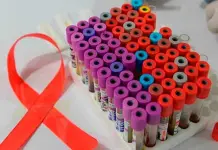 Impacto del recorte de financiamiento de Estados Unidos en la lucha contra el sida Impacto del recorte de financiamiento de Estados Unidos en la lucha contra el sida