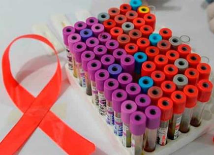 Avances en el Desarrollo de Vacunas Contra el VIH