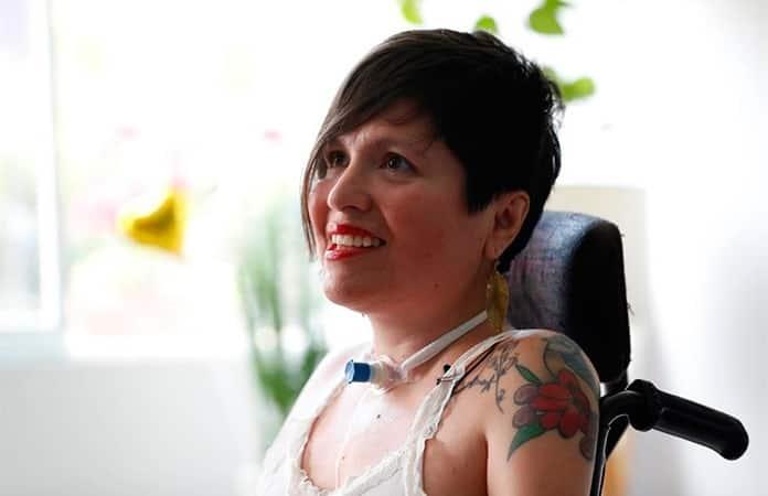 Ana Estrada sufre polimiositis, una enfermedad degenerativa e incurable / Foto: EFE