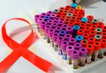 Aumentan 20% casos de enfermedades de transmisi&oacute;n sexual en SLP