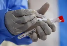 Registran dos nuevos casos de Covid-19 en la capital