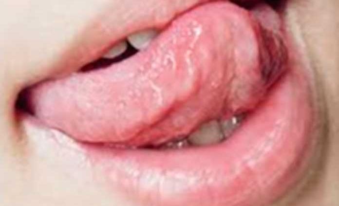 ¿Por qué el sentido del gusto es de gran importancia para la salud?