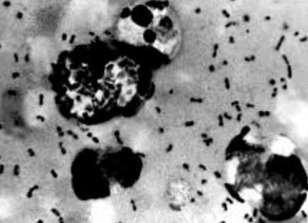 Confirman en Oregón el primer caso humano de peste bubónica