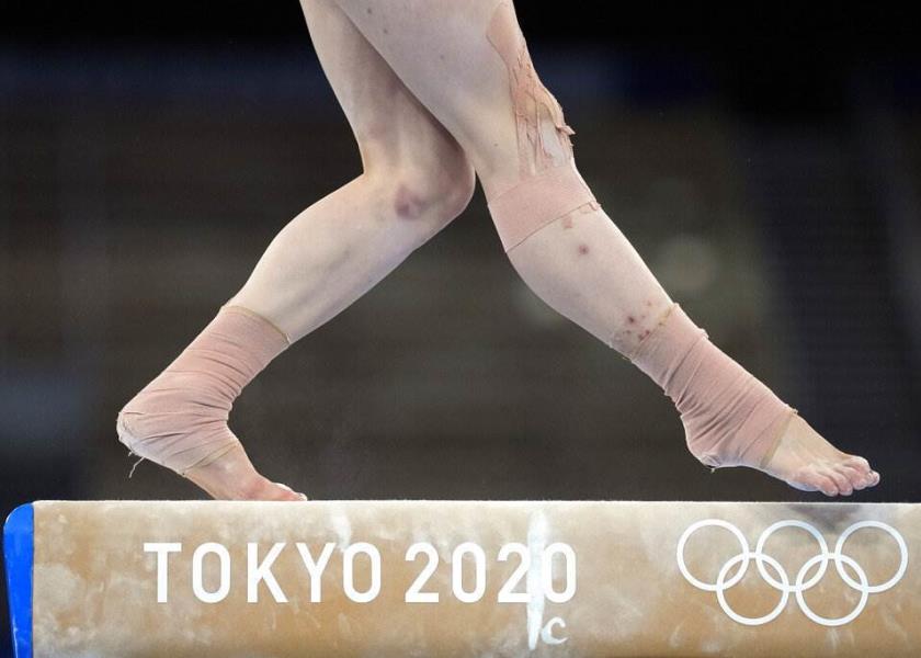 Foto: AP