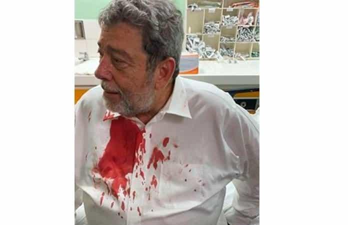 Primer ministro de San Vicente y las Granadinas, Ralph Gonsalves, tras ser golpeado en la cabeza. (EFE/ Ernie Soon)
