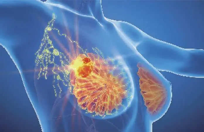 El Ciclo Menstrual y su Vínculo con el Cáncer de Mama