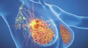 Desarrolla UNAM vacunas terap&eacute;uticas contra c&aacute;ncer de mama