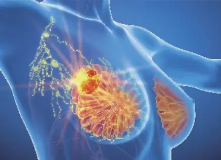 El Ciclo Menstrual y su Vínculo con el Cáncer de Mama