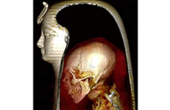 Foto: Frontiers in Medicine