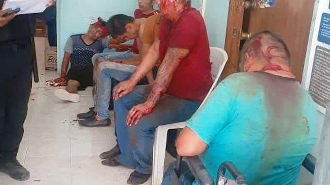 Foto:  ANews Acapulco