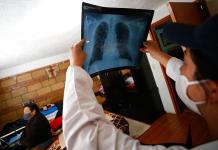 Establecen cómo la contaminación atmosférica puede provocar cáncer de pulmón