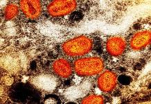 Los casos de viruela símica se han reducido un 90 por ciento en los tres últimos meses