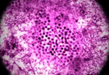 Informe sobre la propagación del Virus del Nilo Occidental en Italia Informe sobre la propagación del Virus del Nilo Occidental en Italia