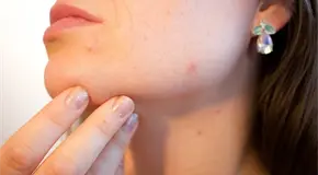 Cómo exfoliar tu piel con bicarbonato de sodio