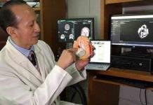 Implanta Issste chip cerebral en pacientes con Parkinson; una potosina entre las beneficiarias