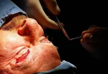 Cacer&iacute;a de falsos cirujanos pl&aacute;sticos