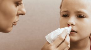 Consejos para tratar la hemorragia nasal en niños