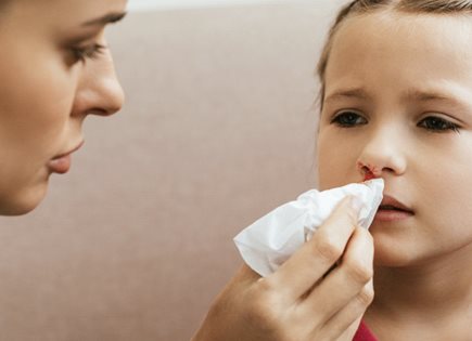Consejos para tratar la hemorragia nasal en niños