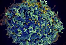 Riesgo de VIH por Procedimientos Cosméticos