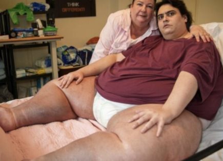 Fallece Jason Holton, el hombre más obeso de Gran Bretaña, a los 33 años