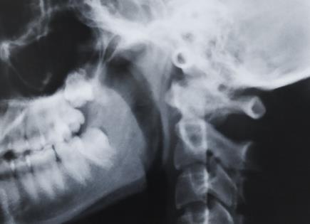 Estudio propone nuevo método para calibrar exploraciones con MicroCT