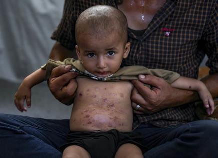 Crisis de enfermedades en la piel en Gaza