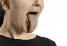 El color de tu lengua puede se&ntilde;alar que padeces diabetes