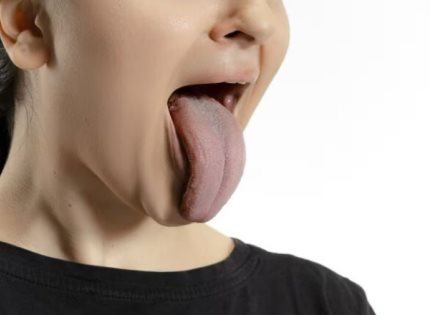 La importancia del color de la lengua en la salud bucal