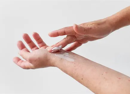 Consejos esenciales para proteger la piel durante el invierno Consejos esenciales para proteger la piel durante el invierno