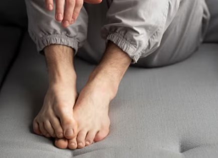 Todo sobre los Hongos en los Pies y su Tratamiento