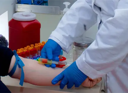 Aumenta detecci&oacute;n de casos de VIH en SLP