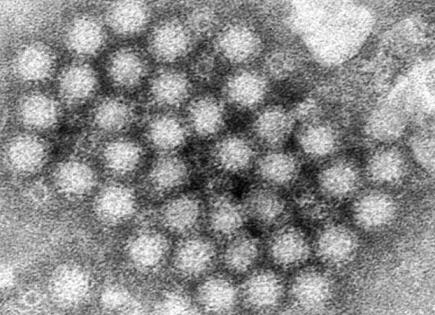 El norovirus regresa con fuerza a EU