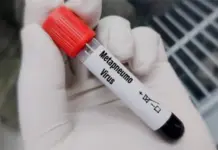 Confirman dos casos de Metapneumovirus en Nuevo Le&oacute;n