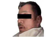 Homicidio de periodista en Teoloyucan