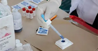 A la baja ETS en SLP, pero aumentan casos de VIH
