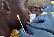 Impacto de los rebeldes en la respuesta al mpox en el Congo Impacto de los rebeldes en la respuesta al mpox en el Congo