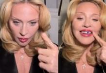 Madonna y su nueva tendencia en accesorios dentales Madonna y su nueva tendencia en accesorios dentales