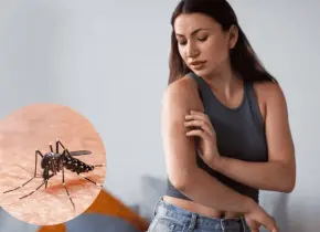 Repelentes naturales: la soluci&oacute;n contra los mosquitos en temporada de lluvias
