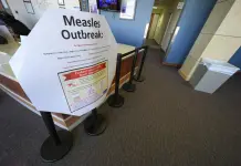 Epidemia de Sarampión en Estados Unidos: últimas actualizaciones y consejos