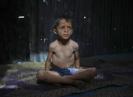 Se agravan hambruna y desnutrición infantil en Gaza