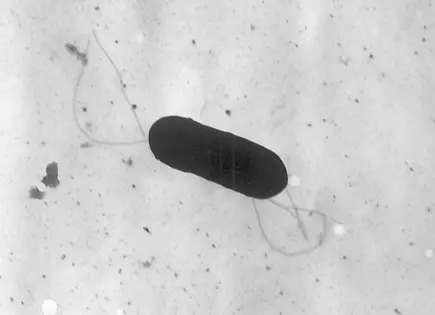 Brote de listeria en EE. UU. afecta a 10 personas