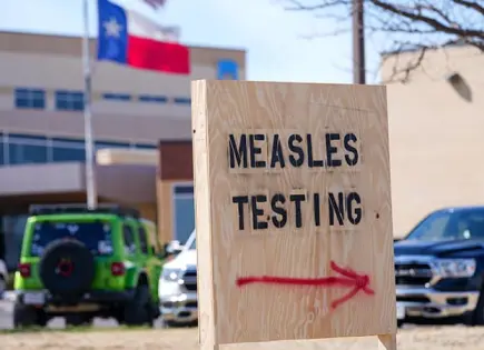 Brotes de sarampión en Estados Unidos: Informe detallado