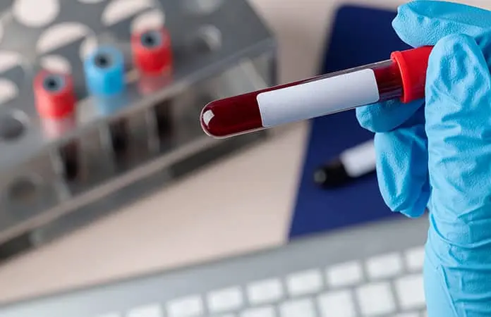 Trasplante logra eliminar el VIH en paciente; ya suman 10 casos